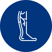 Best Vascular Surgery Hospital in Hyderabad